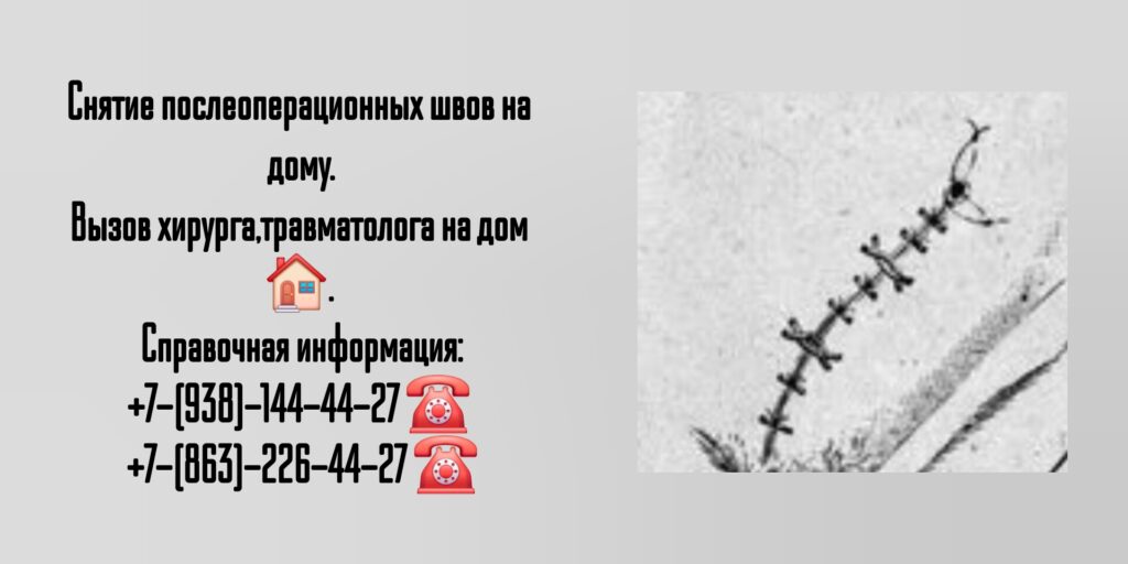 Снятие послеоперационных швов на дому в г. Шахты