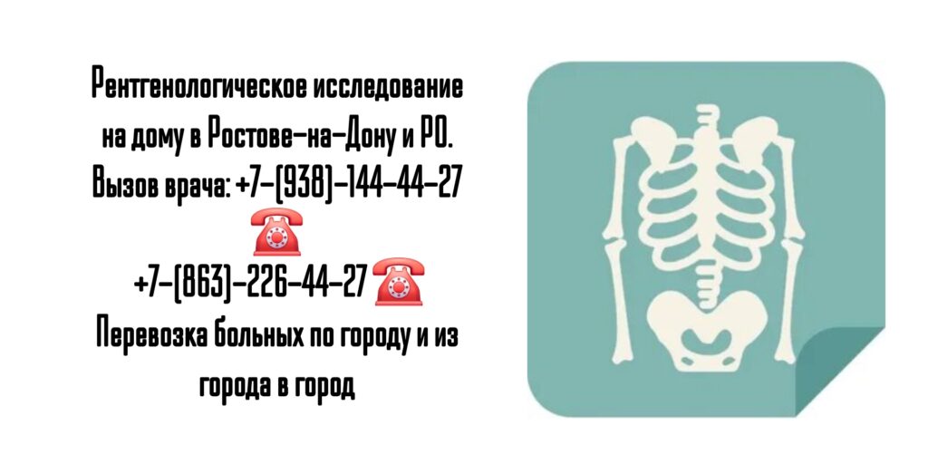 Ростов вызов врача - рентген на дому 