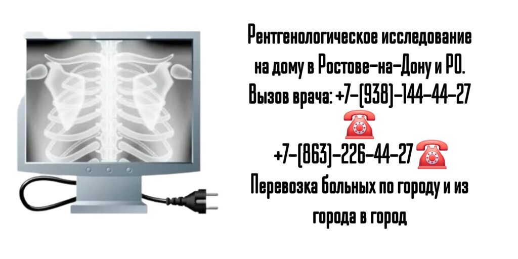 Ростов вызов врача - рентген на дому 