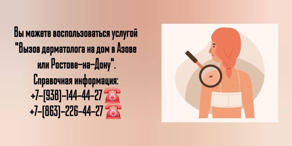 Вызов дерматолога на дом в Ростове-на-Дону и Азове