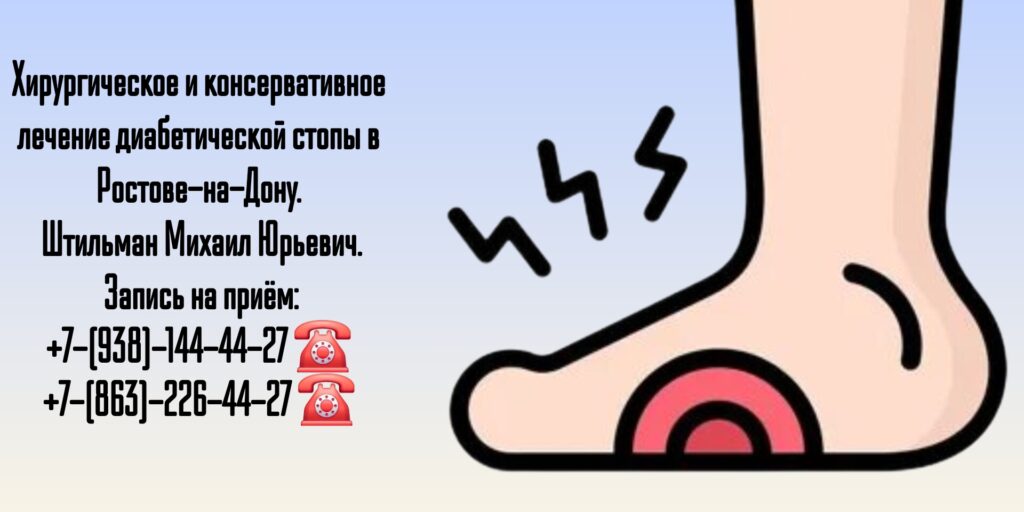 Гнойный хирург Ростов - Штильман Михаил Юрьевич