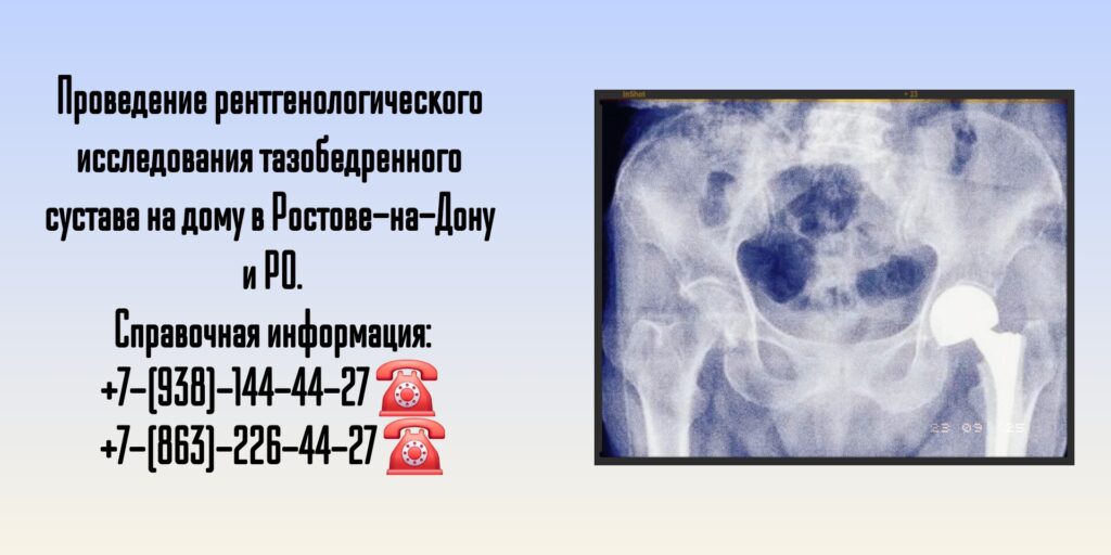Ростов Рентген тазобедренного сустава на дому