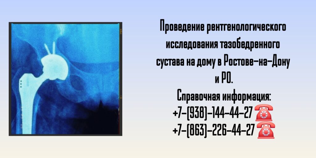 Ростов Рентген тазобедренного сустава на дому