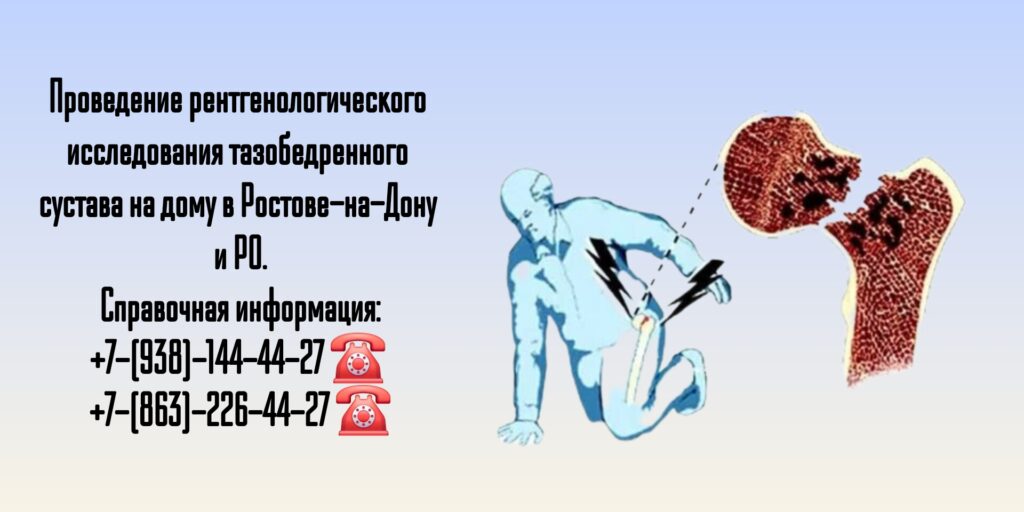 Ростов Рентген тазобедренного сустава на дому