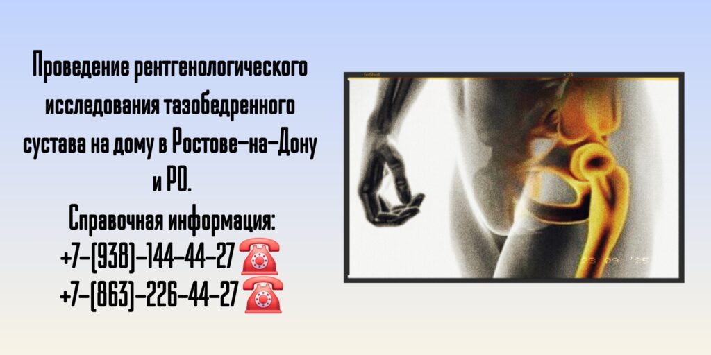 Ростов Рентген тазобедренного сустава на дому