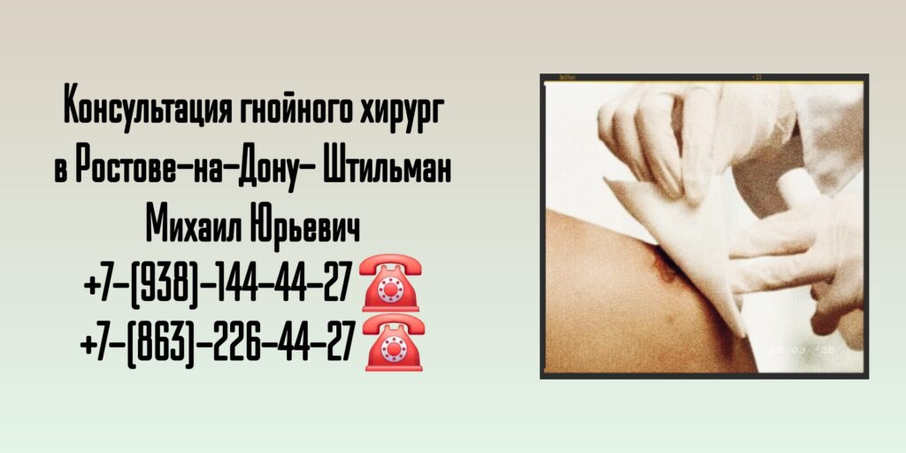 Консультация гнойного хирург в Ростове-на-Дону- Штильман Михаил Юрьевич 