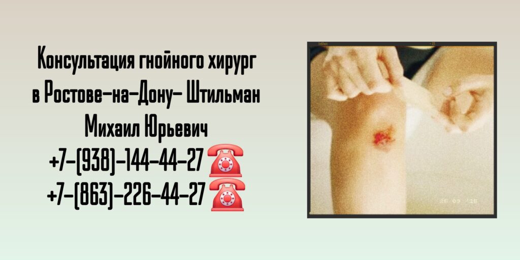 Консультация гнойного хирург в Ростове-на-Дону- Штильман Михаил Юрьевич 