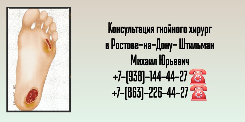 Консультация гнойного хирург в Ростове-на-Дону- Штильман Михаил Юрьевич 