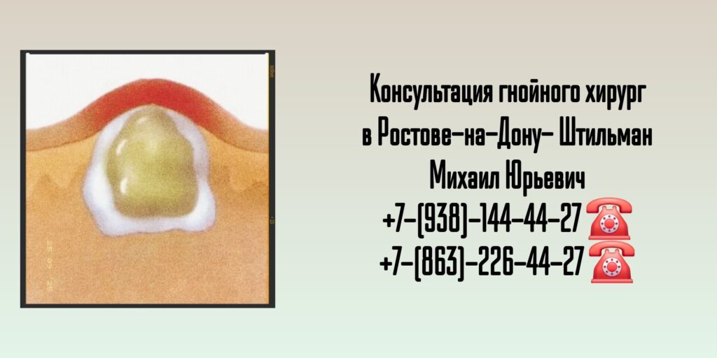 Консультация гнойного хирург в Ростове-на-Дону- Штильман Михаил Юрьевич 