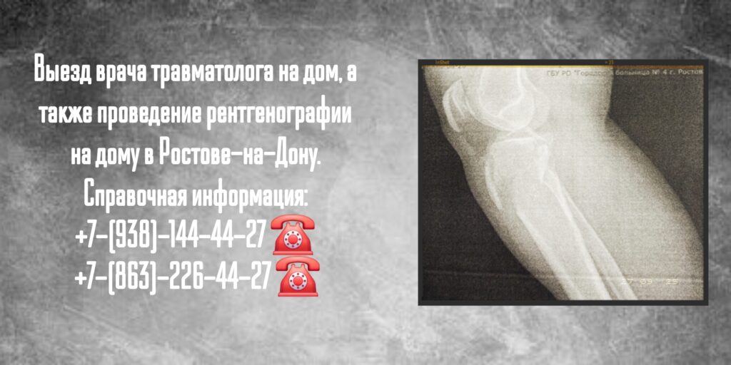 Травматолог на дом Ростов - Рентген на дому 