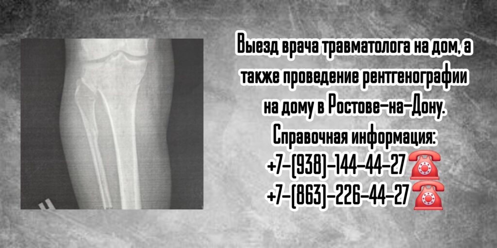 Травматолог на дом Ростов - Рентген на дому 