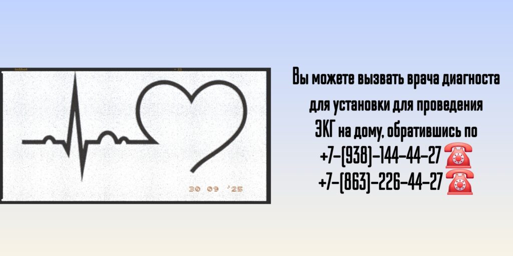 ЭКГ на дом Ростов на дону