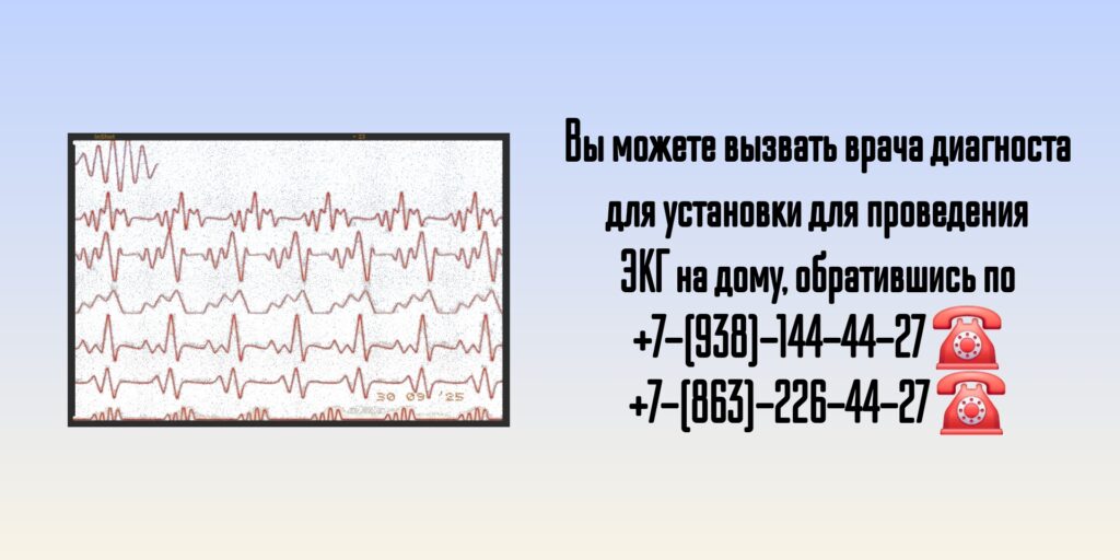 ЭКГ на дом Ростов на дону