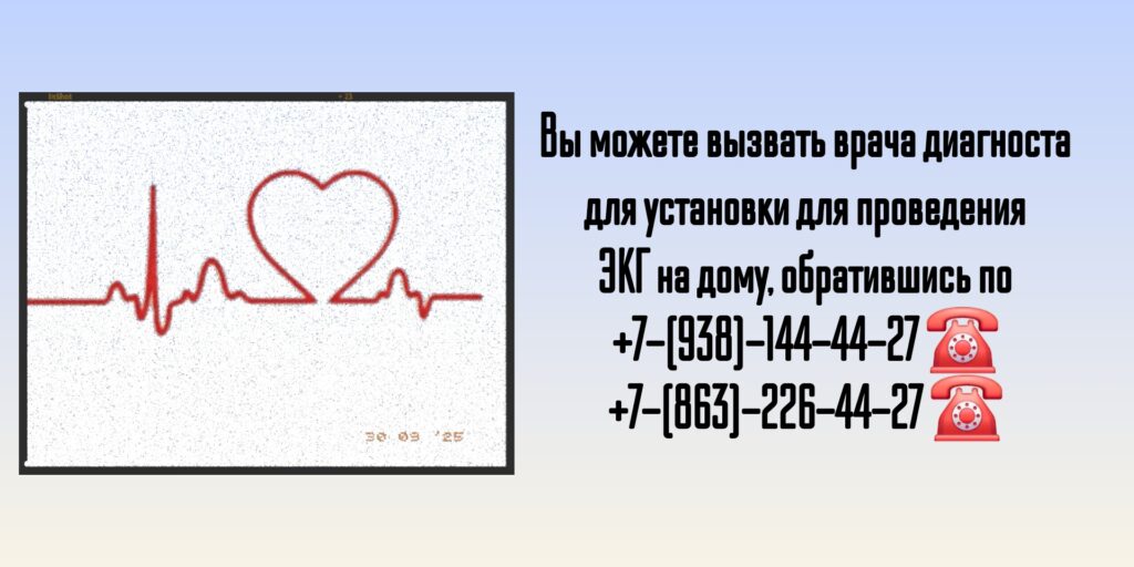 ЭКГ на дом Ростов на дону