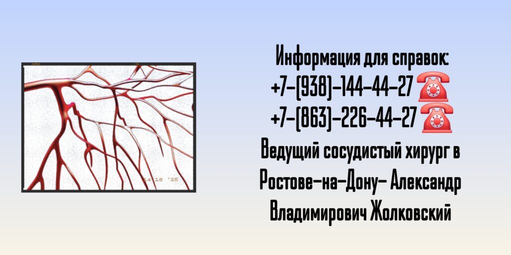 Жолковский Александр Владимирович - ведущий сосудистый хирург в Ростове-на-Дону 
