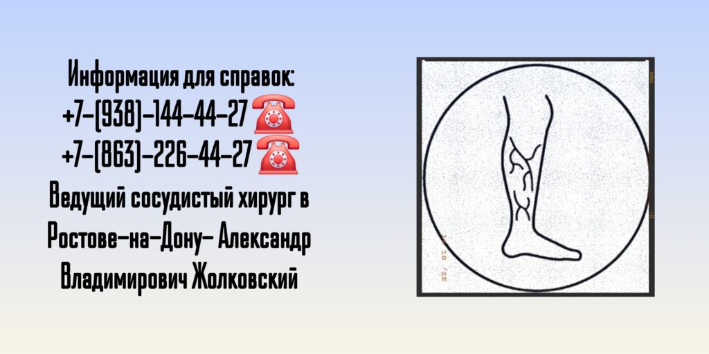 Жолковский Александр Владимирович - ведущий сосудистый хирург в Ростове-на-Дону 