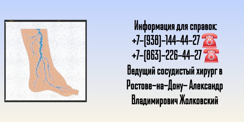 Жолковский Александр Владимирович - ведущий сосудистый хирург в Ростове-на-Дону 