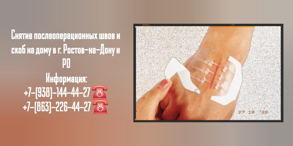 Снятие послеоперационных швов и скоб на дому - Ростов-на-Дону и РО