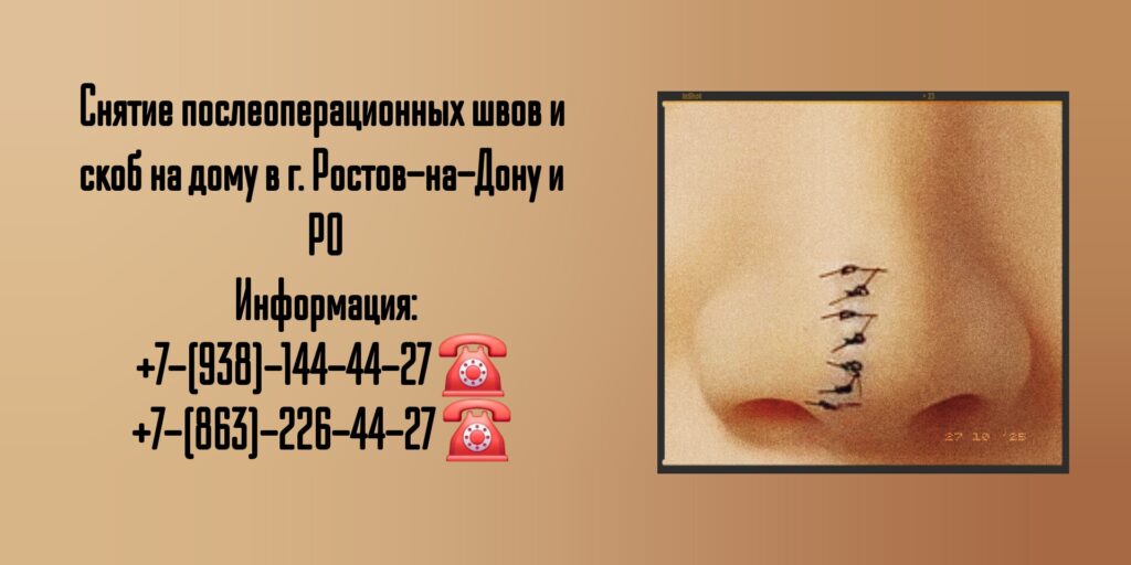 Снятие послеоперационных швов и скоб на дому - Ростов-на-Дону и РО