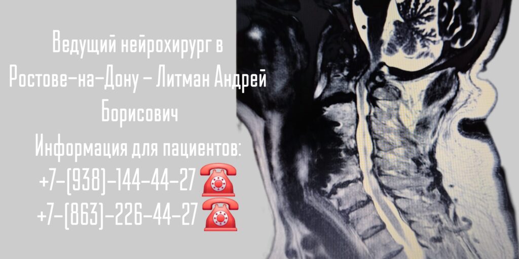 Нейрохирург Ростов-на-Дону - Литман Андрей Борисович