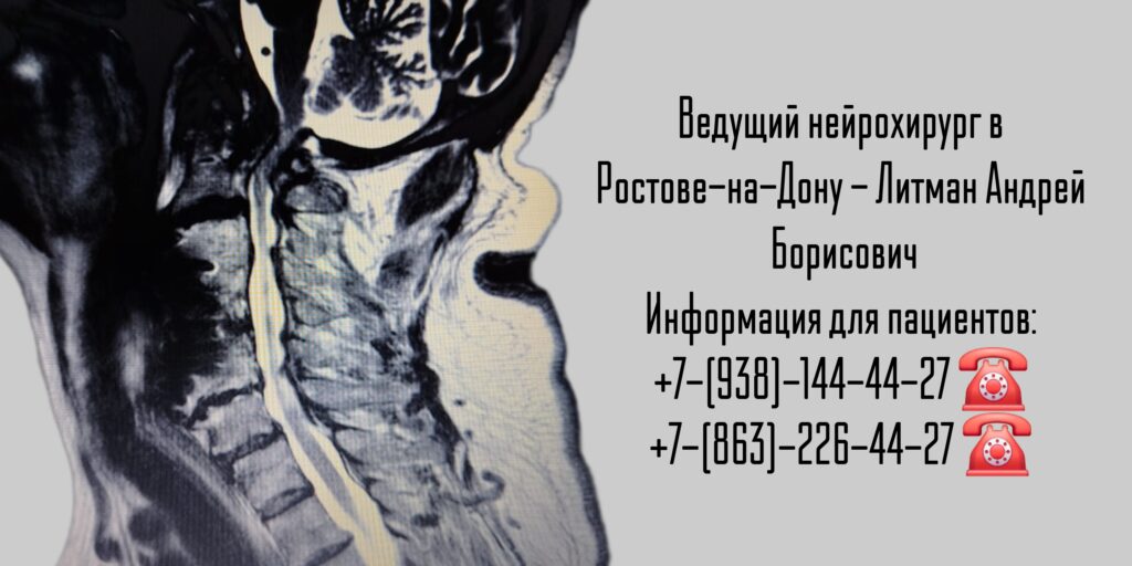 Нейрохирург Ростов-на-Дону - Литман Андрей Борисович