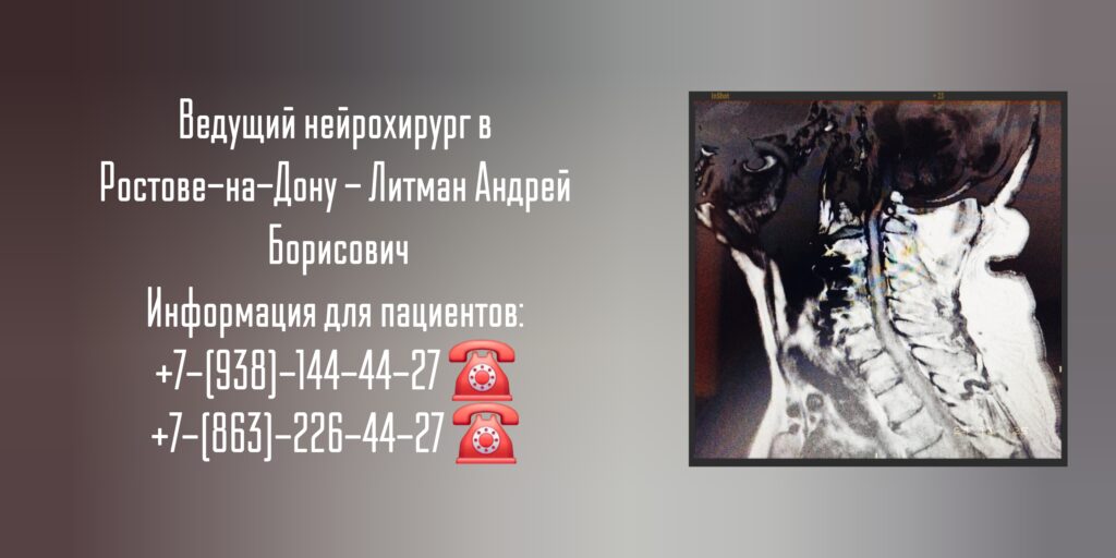Нейрохирург Ростов-на-Дону - Литман Андрей Борисович
