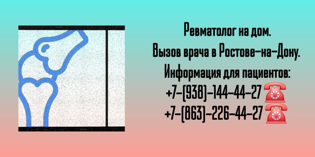 Консультация ревматолога на дому - вызов врача Ростов