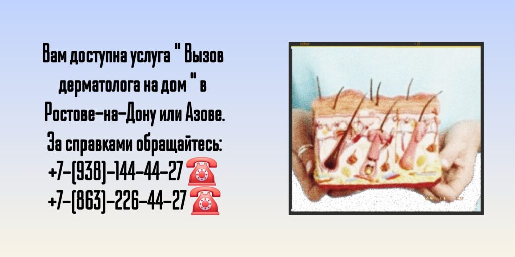 Вызов дерматолога на дом г Ростов-на-Дону и г Азов