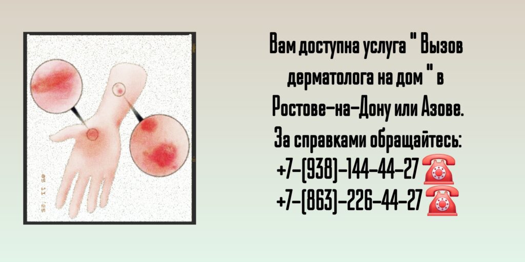 Вызов дерматолога на дом г Ростов-на-Дону и г Азов