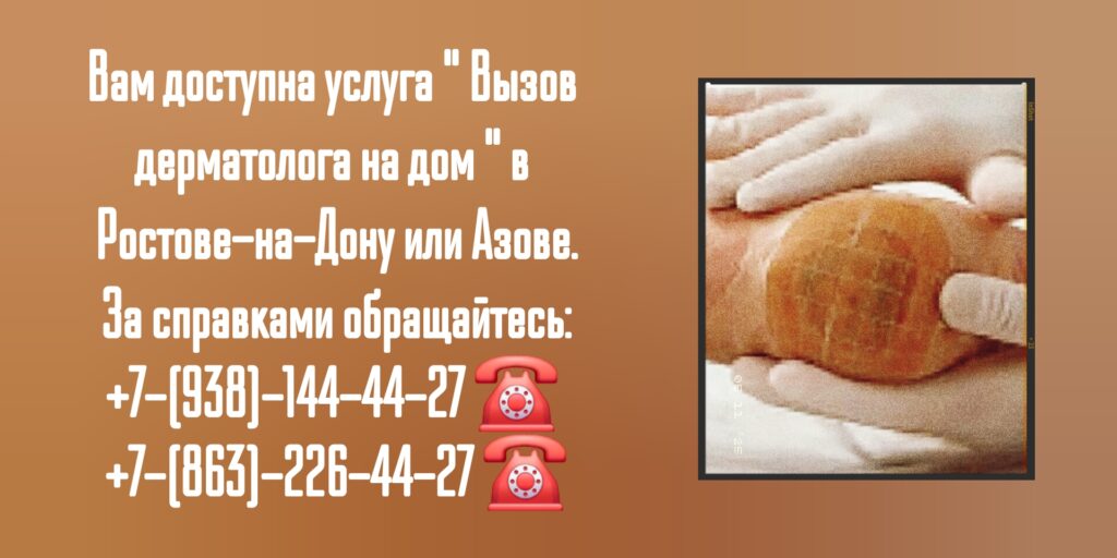 Вызов дерматолога на дом г Ростов-на-Дону и г Азов