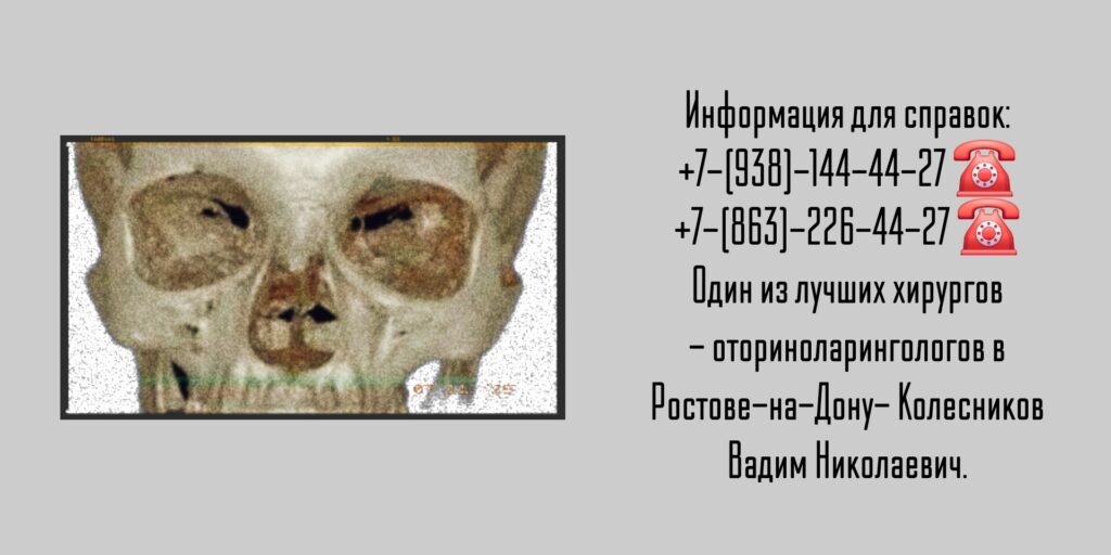 Ростов оториноларинголог - Колесников Вадим Николаевич 