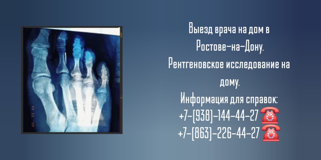 Выезд врача на дом в Ростове-на-Дону.

Рентгеновское исследование на дому.