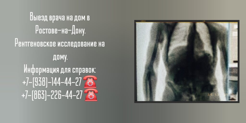 Выезд врача на дом в Ростове-на-Дону.

Рентгеновское исследование на дому.