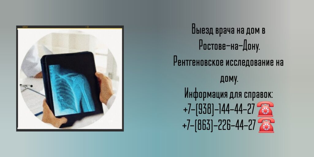 Выезд врача на дом в Ростове-на-Дону.

Рентгеновское исследование на дому.