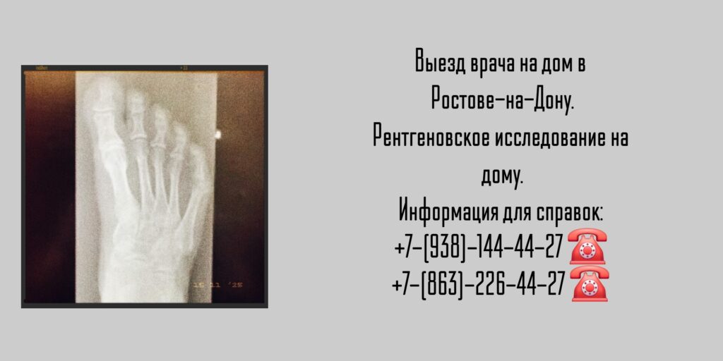 Выезд врача на дом в Ростове-на-Дону.

Рентгеновское исследование на дому.