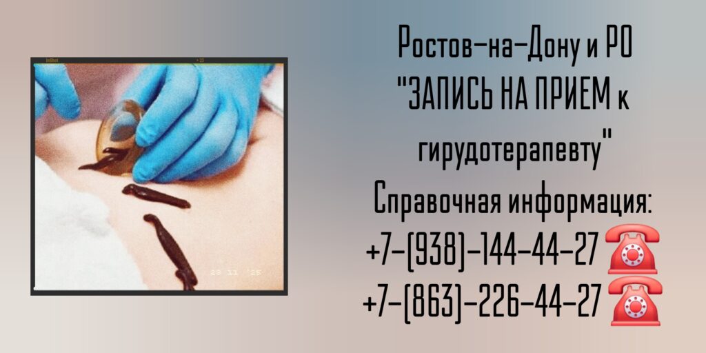Гирудотерапевт в Ростове-на-Дону- Кублов Андрей Владимирович 