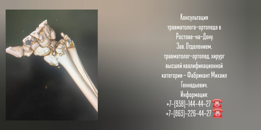 Фабрикант Михаил Геннадьевич - травматолог в Ростове-на-Дону 