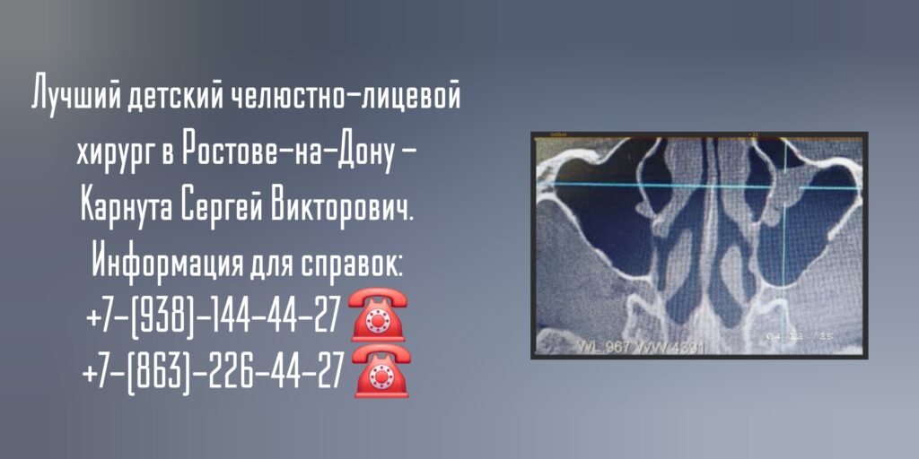 Карнута Сергей Викторович- Детский челюстно-лицевой хирург Ростов