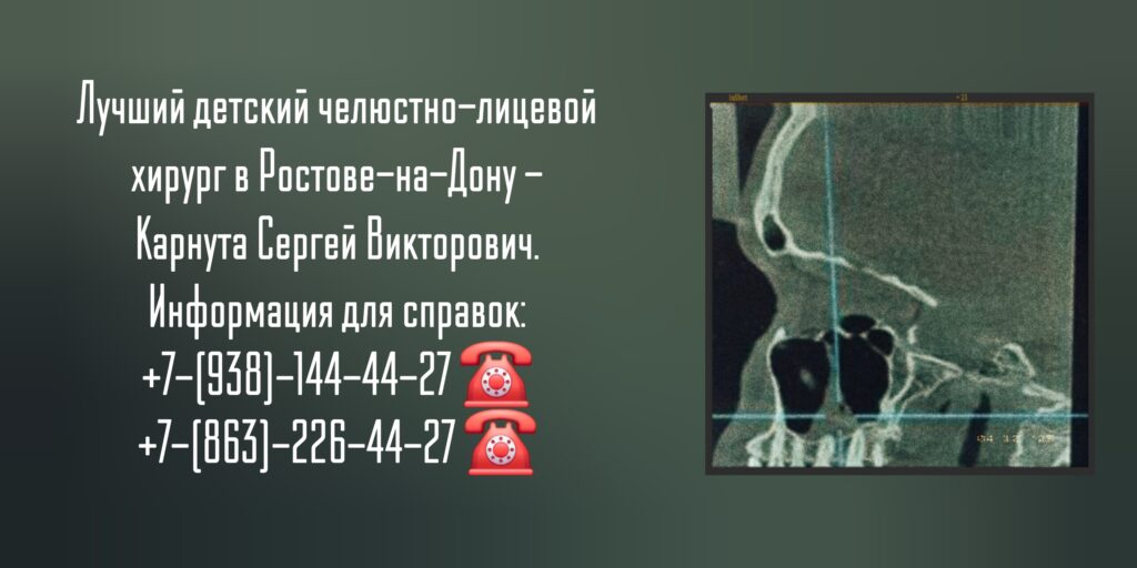 Карнута Сергей Викторович- Детский челюстно-лицевой хирург Ростов