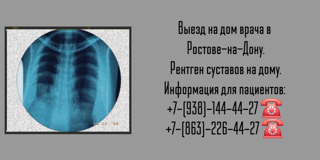 Ростов выезд врача - Рентген на дому