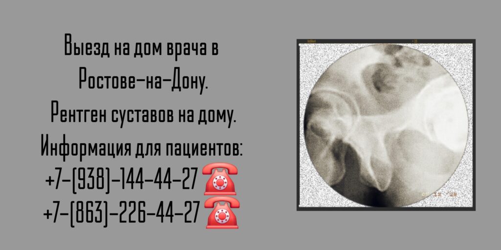 Ростов выезд врача - Рентген на дому