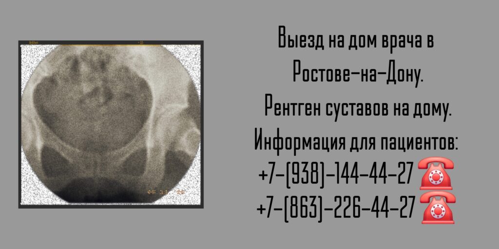Ростов выезд врача - Рентген на дому