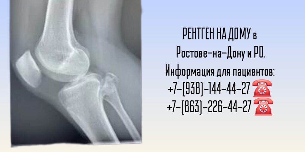 Беккер Юрий Наумович - травматолог в Пензе