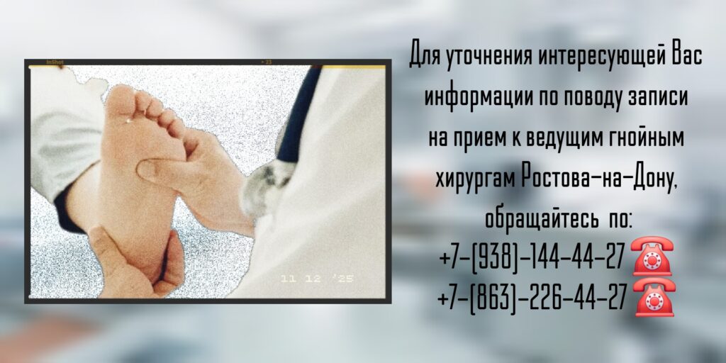 Диабетическая стопа - хирургическое лечение в Ростове-на-Дону - Штильман Михаил Юрьевич