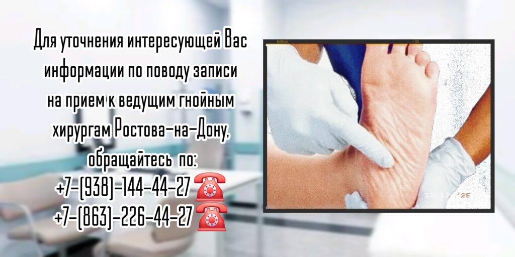 Диабетическая стопа - хирургическое лечение в Ростове-на-Дону - Штильман Михаил Юрьевич