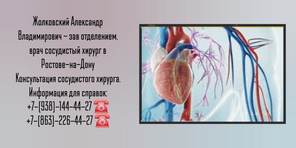 Жолковский А В - сосудистый хирург в Ростове-на-Дону 