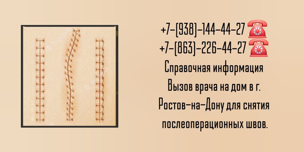 Снять швы после операции на дому в Ростове-на-Дону 