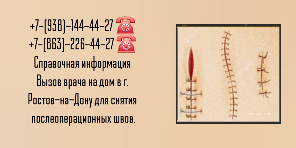Снять швы после операции на дому в Ростове-на-Дону 