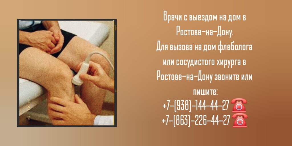 Сосудистый хирург вызов на дом Ростов-на-Дону