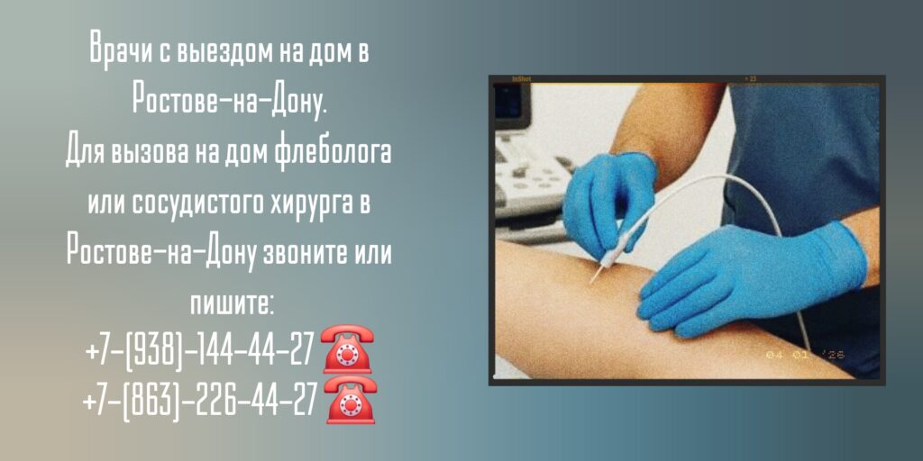 Сосудистый хирург вызов на дом Ростов-на-Дону